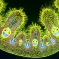 Marijuana as seen through the microscope